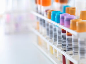McDermott Advises NORD Holding on the Acquisition of HKS health solutions and on the Financing of the Acquisition