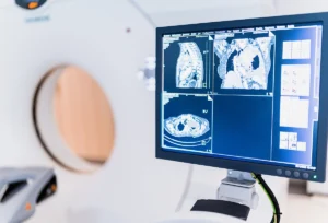 Where MedTech is attracting PE attention with less FDA burden